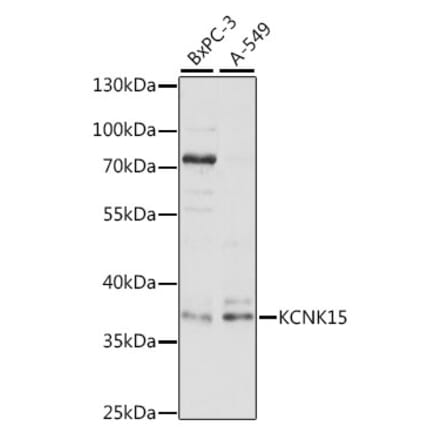 Western Blot - Anti-KCNK15 Antibody (A89433) - Antibodies.com