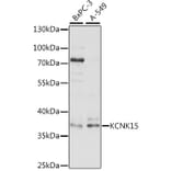 Western Blot - Anti-KCNK15 Antibody (A89433) - Antibodies.com