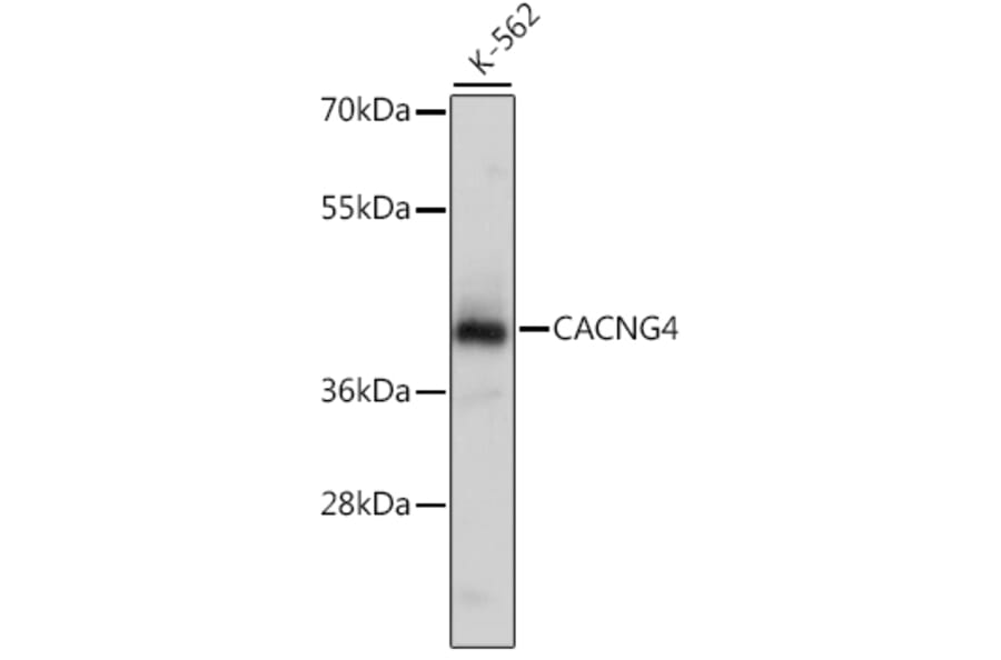 Western Blot - Anti-CACNG4 Antibody (A16286) - Antibodies.com