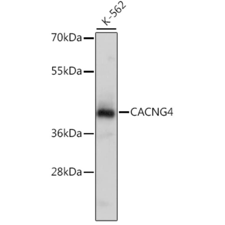 Western Blot - Anti-CACNG4 Antibody (A16286) - Antibodies.com