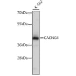 Western Blot - Anti-CACNG4 Antibody (A16286) - Antibodies.com