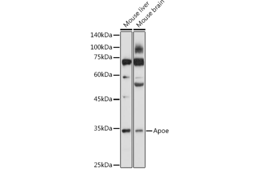 Western Blot - Anti-APOE Antibody (A89435) - Antibodies.com