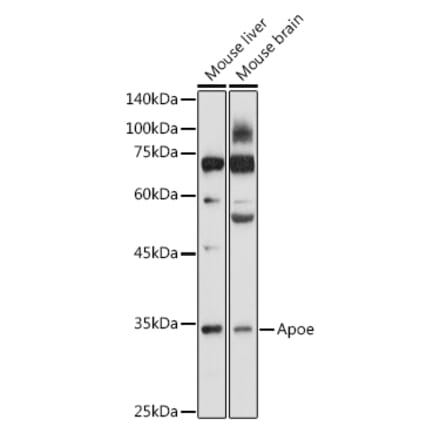 Western Blot - Anti-APOE Antibody (A89435) - Antibodies.com