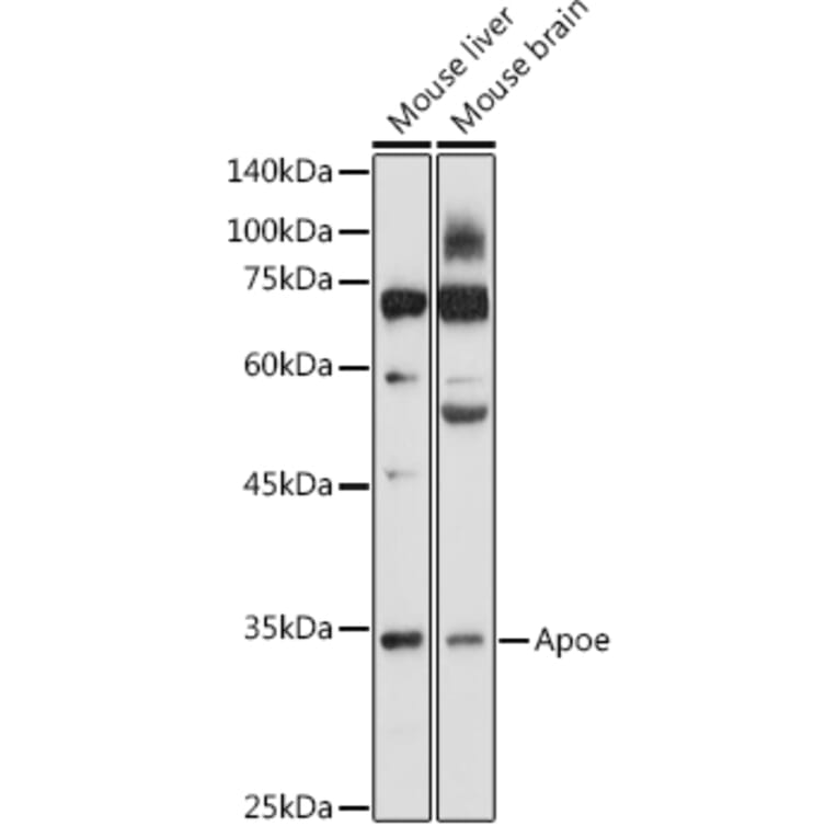 Western Blot - Anti-APOE Antibody (A89435) - Antibodies.com