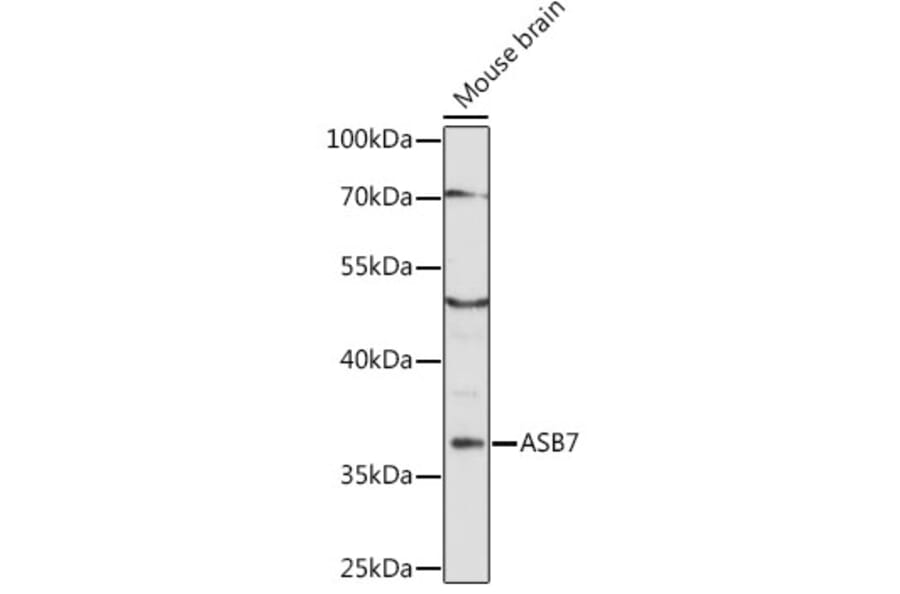Western Blot - Anti-ASB7 Antibody (A89436) - Antibodies.com