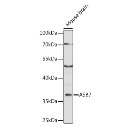 Western Blot - Anti-ASB7 Antibody (A89436) - Antibodies.com