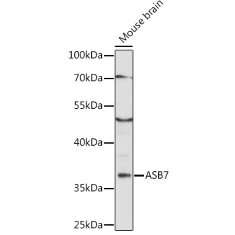 Western Blot - Anti-ASB7 Antibody (A89436) - Antibodies.com