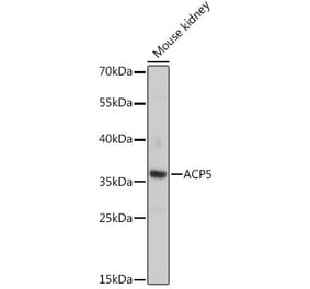 Western Blot - Anti-Tartrate Resistant Acid Phosphatase Antibody (A89437) - Antibodies.com