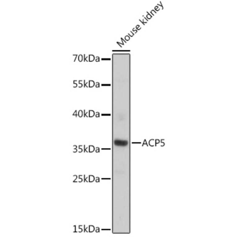 Western Blot - Anti-Tartrate Resistant Acid Phosphatase Antibody (A89437) - Antibodies.com