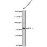 Western Blot - Anti-Tartrate Resistant Acid Phosphatase Antibody (A89437) - Antibodies.com