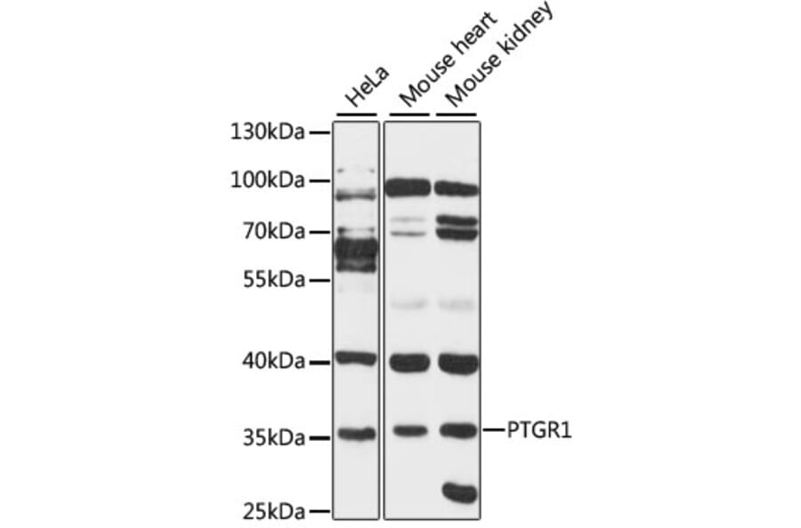 Western Blot - Anti-PTGR1 Antibody (A89439) - Antibodies.com