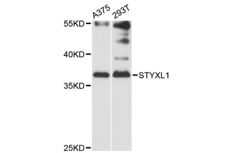 Western Blot - Anti-STYXL1 Antibody (A12850) - Antibodies.com