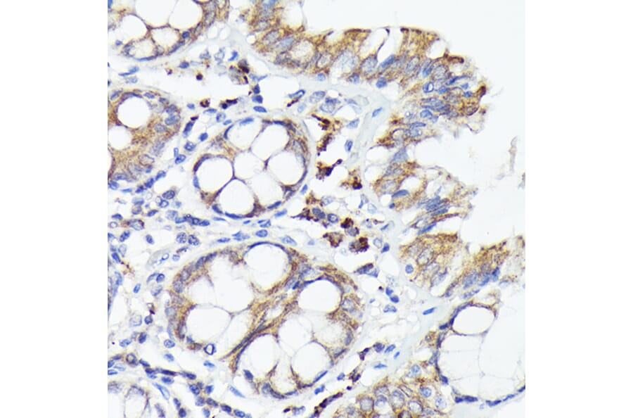 Immunohistochemistry - Anti-IL-1 alpha Antibody (A89441) - Antibodies.com