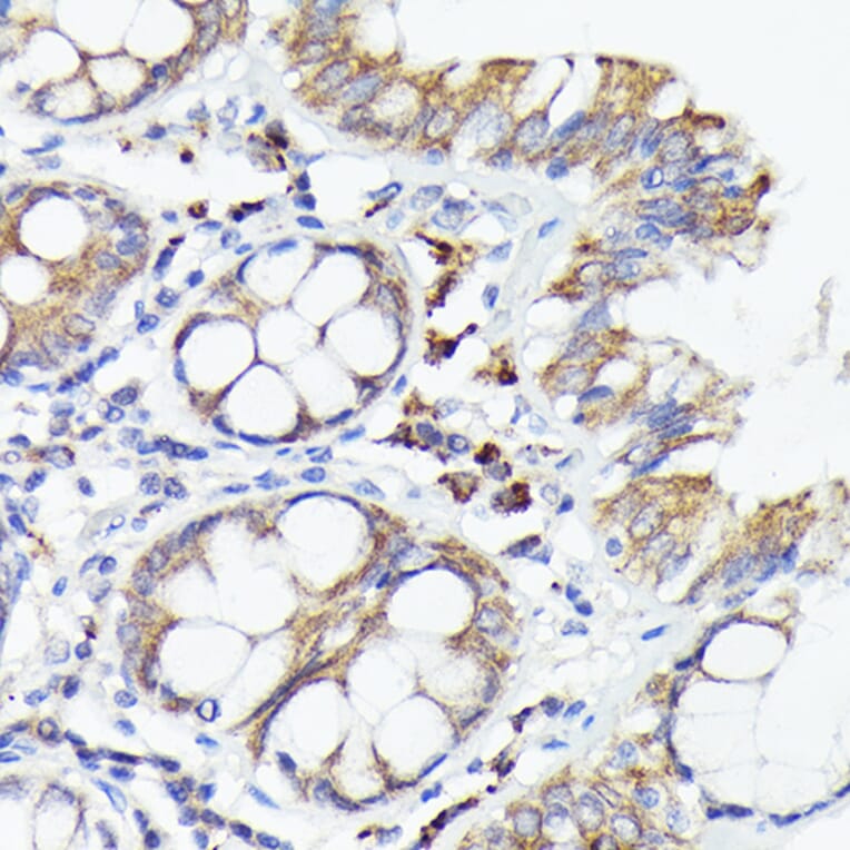 Immunohistochemistry - Anti-IL-1 alpha Antibody (A89441) - Antibodies.com
