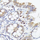 Immunohistochemistry - Anti-IL-1 alpha Antibody (A89441) - Antibodies.com