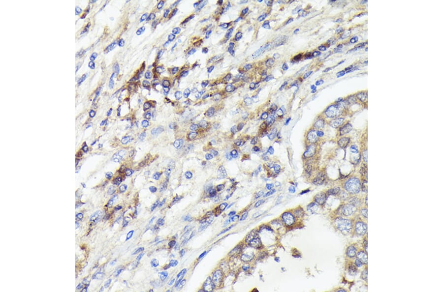 Immunohistochemistry - Anti-IL-1 alpha Antibody (A89441) - Antibodies.com