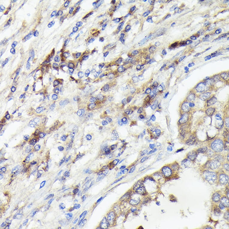 Immunohistochemistry - Anti-IL-1 alpha Antibody (A89441) - Antibodies.com