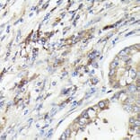 Immunohistochemistry - Anti-IL-1 alpha Antibody (A89441) - Antibodies.com