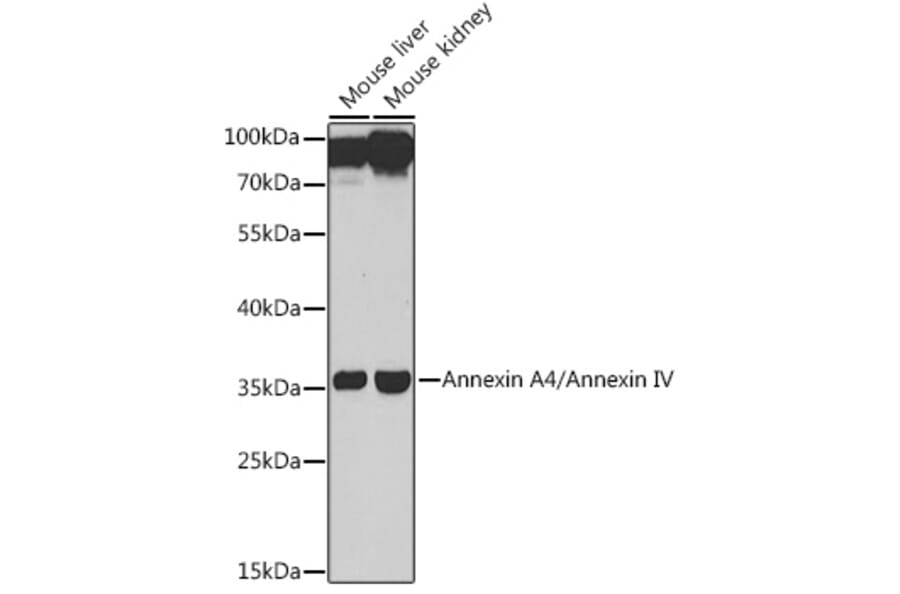 Western Blot - Anti-Annexin-4/ANXA4 Antibody (A89442) - Antibodies.com