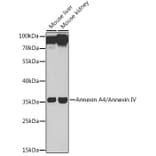 Western Blot - Anti-Annexin-4/ANXA4 Antibody (A89442) - Antibodies.com