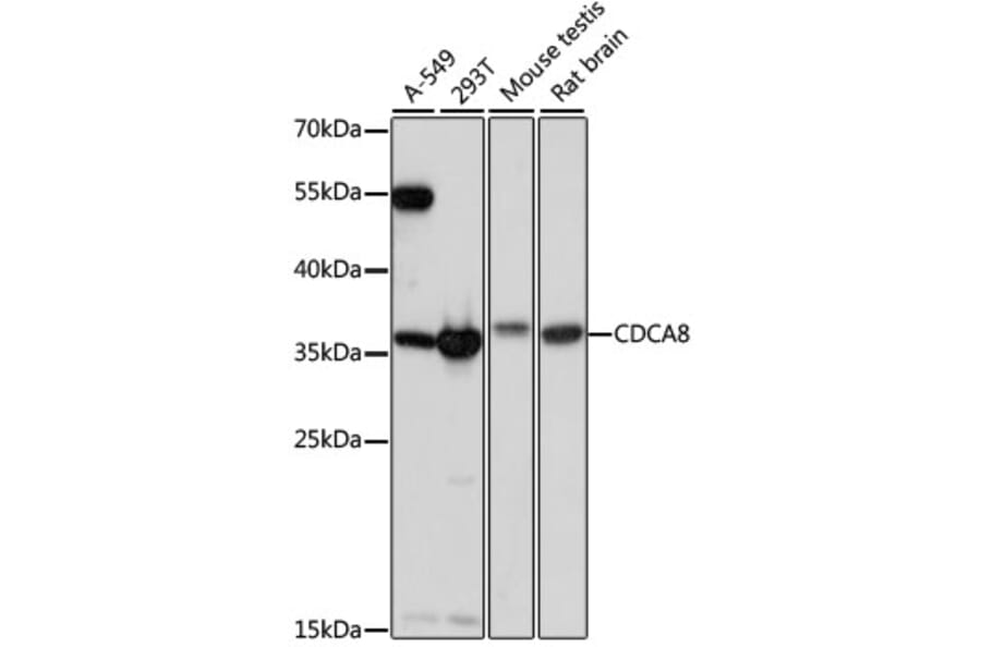 Western Blot - Anti-Borealin/CDCA8 Antibody (A89443) - Antibodies.com