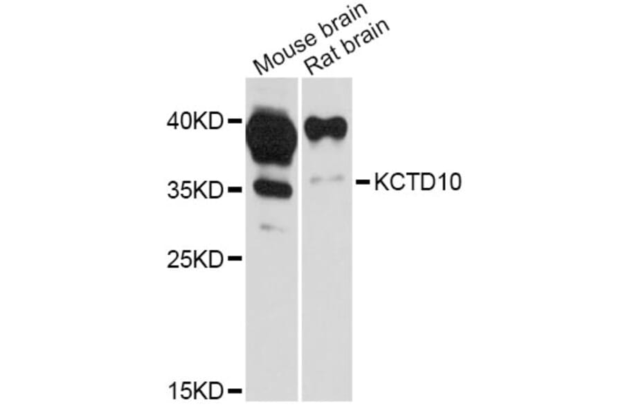 Western Blot - Anti-KCTD10 Antibody (A12115) - Antibodies.com