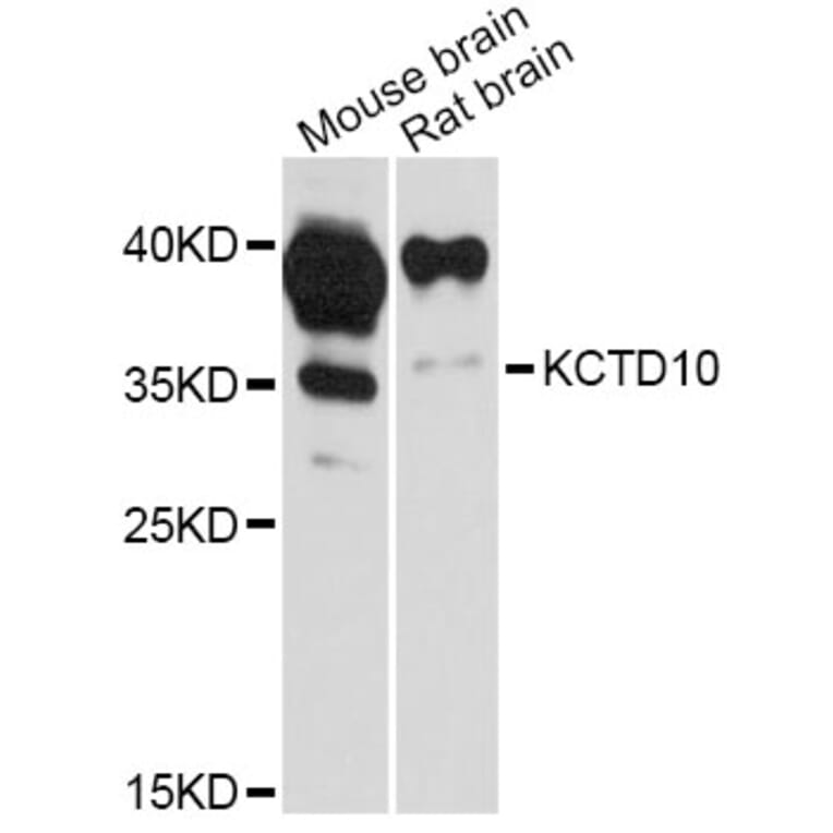 Western Blot - Anti-KCTD10 Antibody (A12115) - Antibodies.com