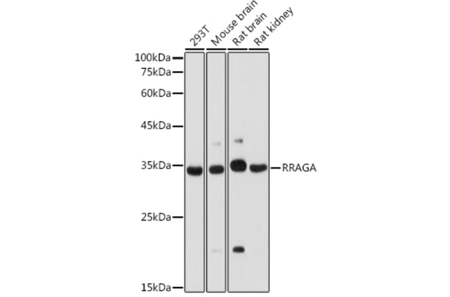 Western Blot - Anti-Rag A Antibody (A89445) - Antibodies.com