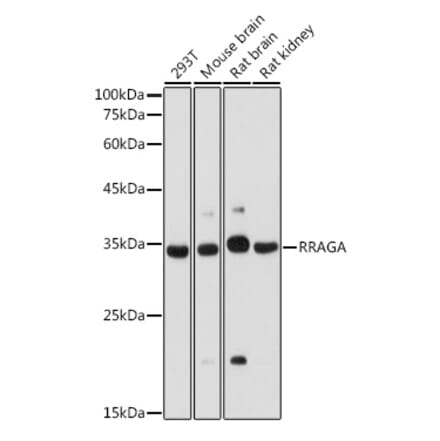 Western Blot - Anti-Rag A Antibody (A89445) - Antibodies.com