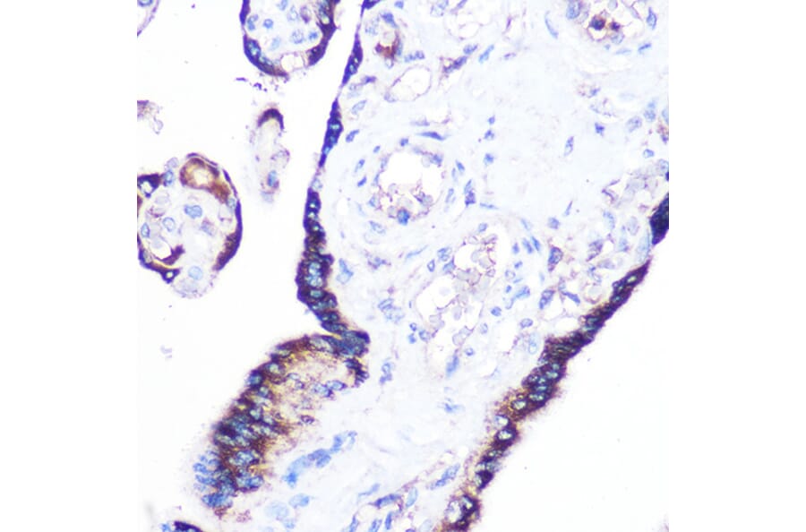 Immunohistochemistry - Anti-Rag A Antibody (A89445) - Antibodies.com