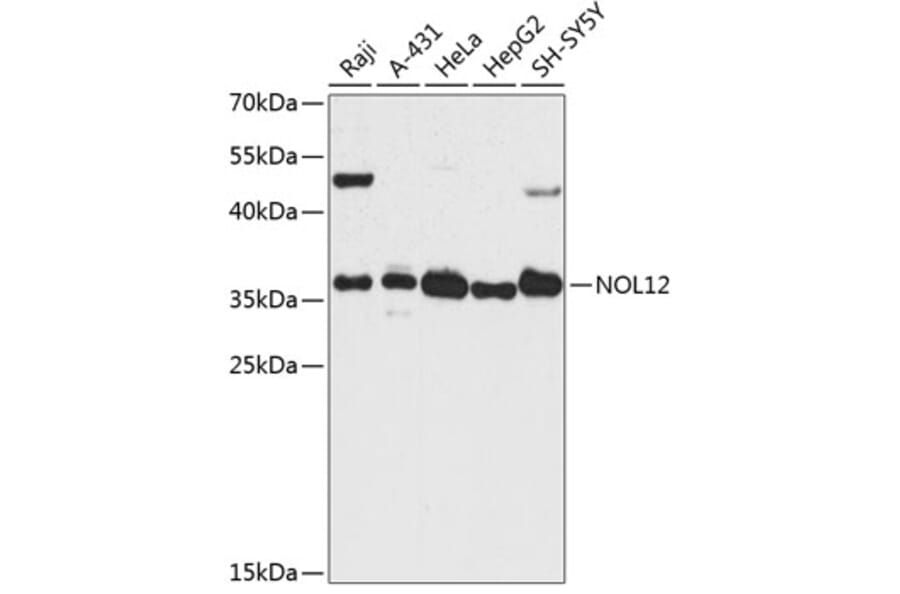 Western Blot - Anti-NOL12 Antibody (A89447) - Antibodies.com