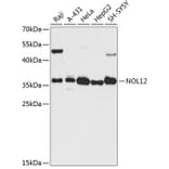 Western Blot - Anti-NOL12 Antibody (A89447) - Antibodies.com
