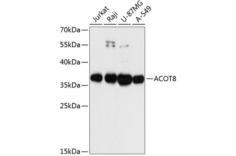 Western Blot - Anti-Acyl-coenzyme A Thioesterase 8 Antibody (A89448) - Antibodies.com