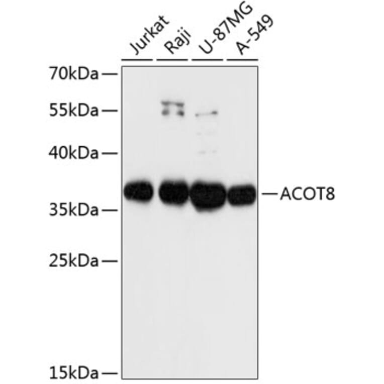 Western Blot - Anti-Acyl-coenzyme A Thioesterase 8 Antibody (A89448) - Antibodies.com