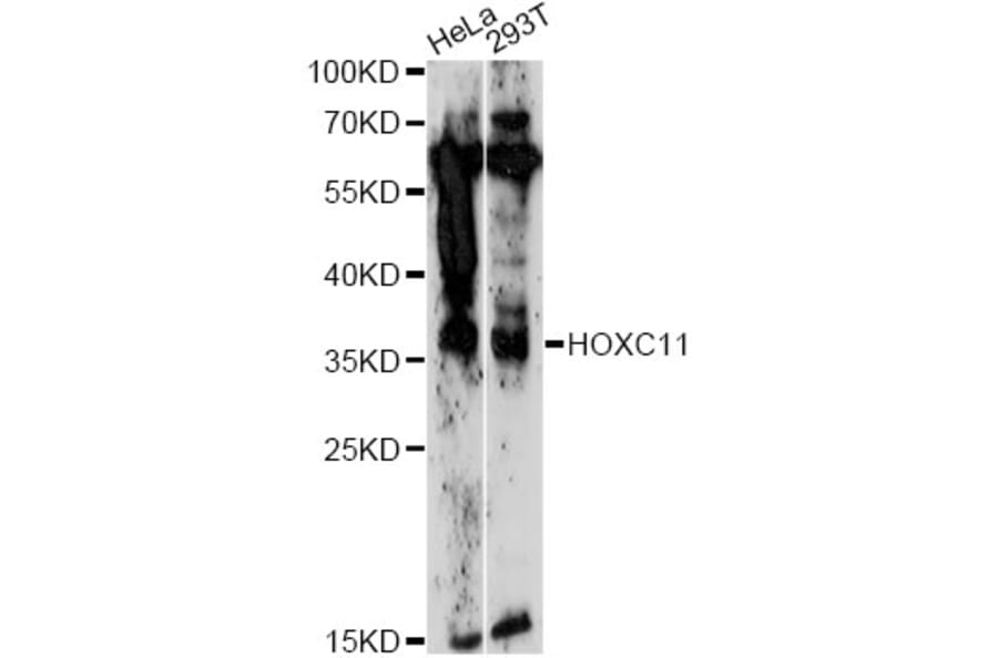 Western Blot - Anti-HOXC11 Antibody (A14742) - Antibodies.com