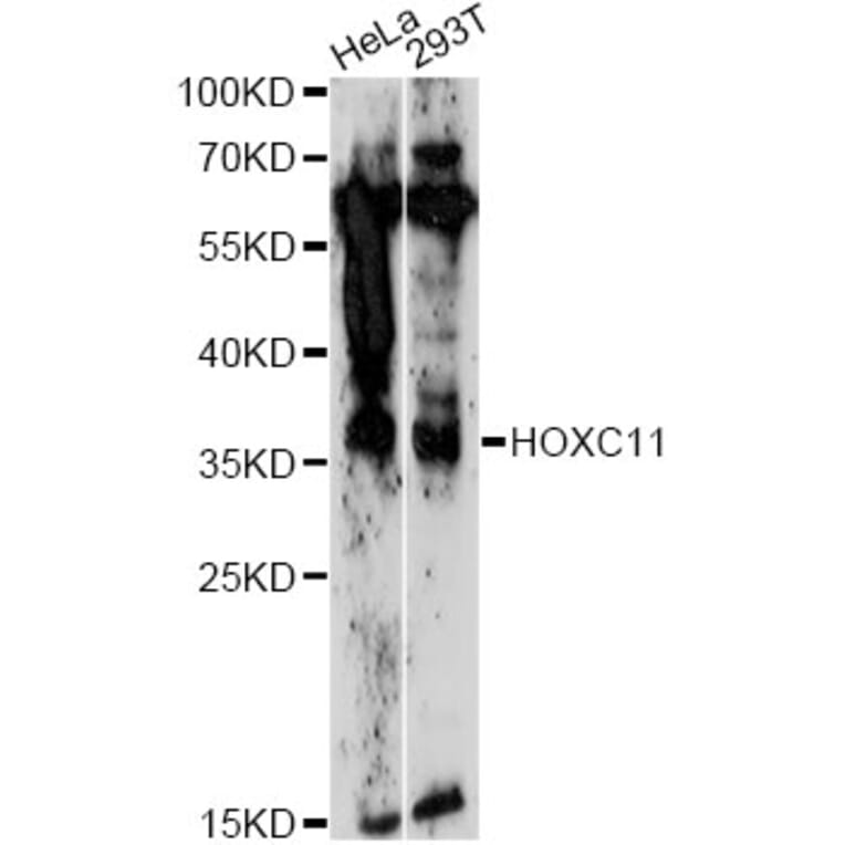 Western Blot - Anti-HOXC11 Antibody (A14742) - Antibodies.com