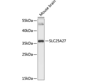 Western Blot - Anti-UCP4 Antibody (A89450) - Antibodies.com
