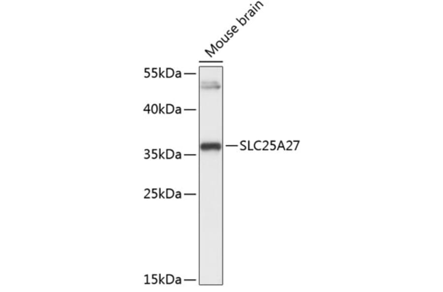 Western Blot - Anti-UCP4 Antibody (A89450) - Antibodies.com