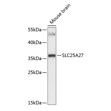 Western Blot - Anti-UCP4 Antibody (A89450) - Antibodies.com