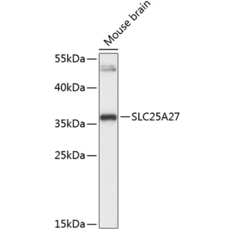 Western Blot - Anti-UCP4 Antibody (A89450) - Antibodies.com