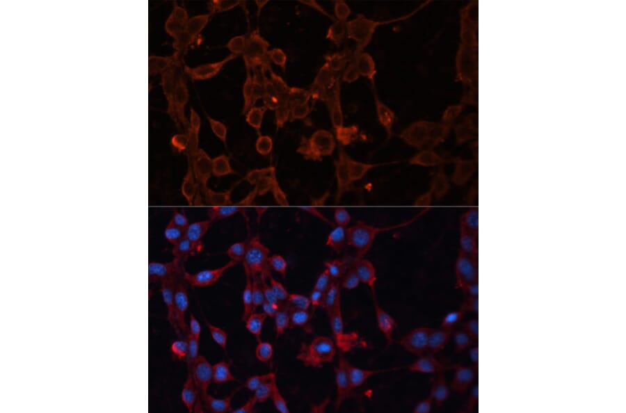Immunofluorescence - Anti-UCP4 Antibody (A89450) - Antibodies.com