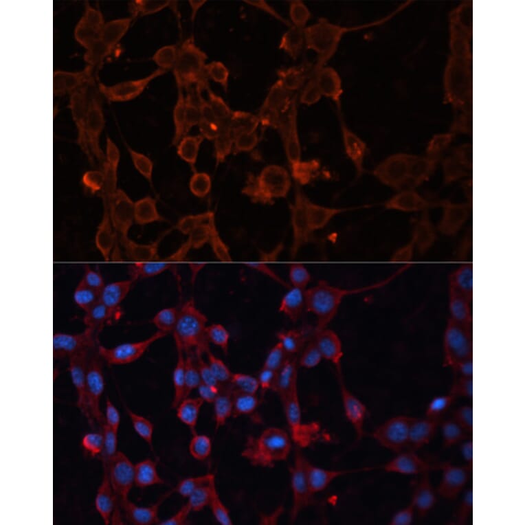 Immunofluorescence - Anti-UCP4 Antibody (A89450) - Antibodies.com