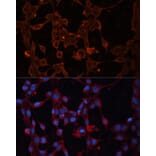 Immunofluorescence - Anti-UCP4 Antibody (A89450) - Antibodies.com