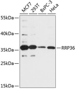 Western blot analysis of extracts of various cell lines, using Anti-RRP36 Antibody (A14328) at 1:3000 dilution.
Secondary antibody: Goat Anti-Rabbit IgG (H+L) (HRP) (AS014) at 1:10,000 dilution.
Lysates / proteins: 25µg per lane.
Blocking buffer: 3% non-fat dry milk in TBST.
Detection: ECL Basic Kit (RM00020).
Exposure time: 90s.