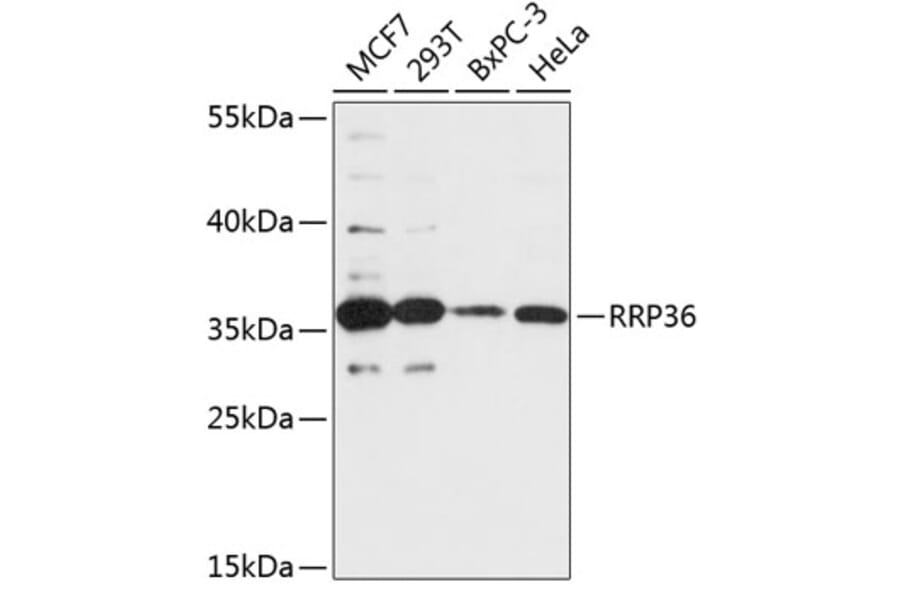 Western Blot - Anti-RRP36 Antibody (A89451) - Antibodies.com