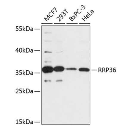Western Blot - Anti-RRP36 Antibody (A89451) - Antibodies.com
