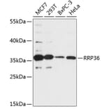 Western Blot - Anti-RRP36 Antibody (A89451) - Antibodies.com