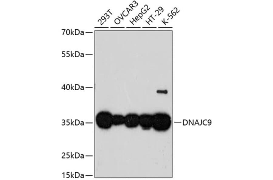Western Blot - Anti-DNAJC9 Antibody (A89452) - Antibodies.com