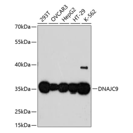 Western Blot - Anti-DNAJC9 Antibody (A89452) - Antibodies.com