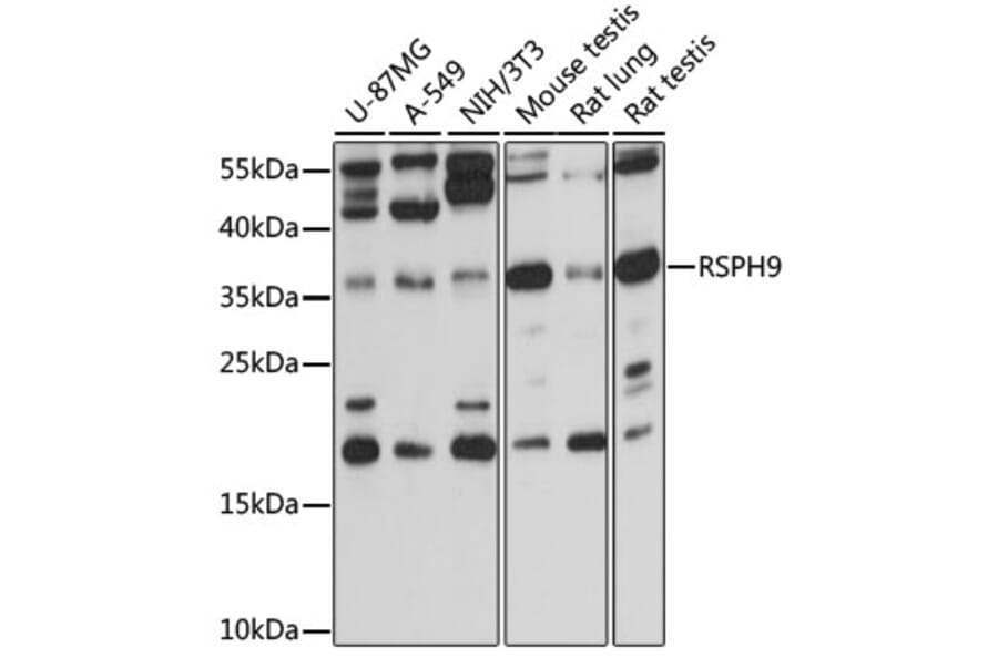 Western Blot - Anti-RSPH9 Antibody (A15972) - Antibodies.com